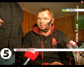 Лидер автомайдана Дмитрий Булатов подвергся жестоким пыткам